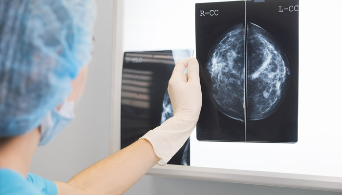 Learn Why Breast Density Matters