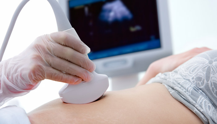 Prenatal Genetic Screening
